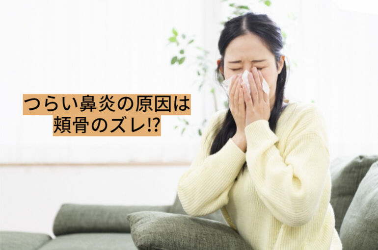 花粉症　頬骨